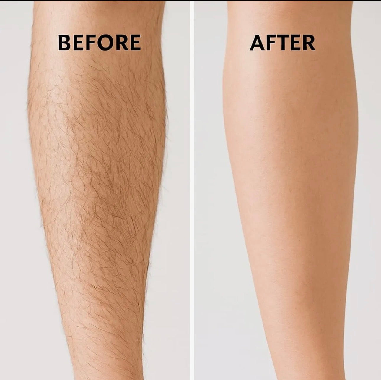 Imported Dove 4D Hair Removal Spray – Painless Formula For Men & Women